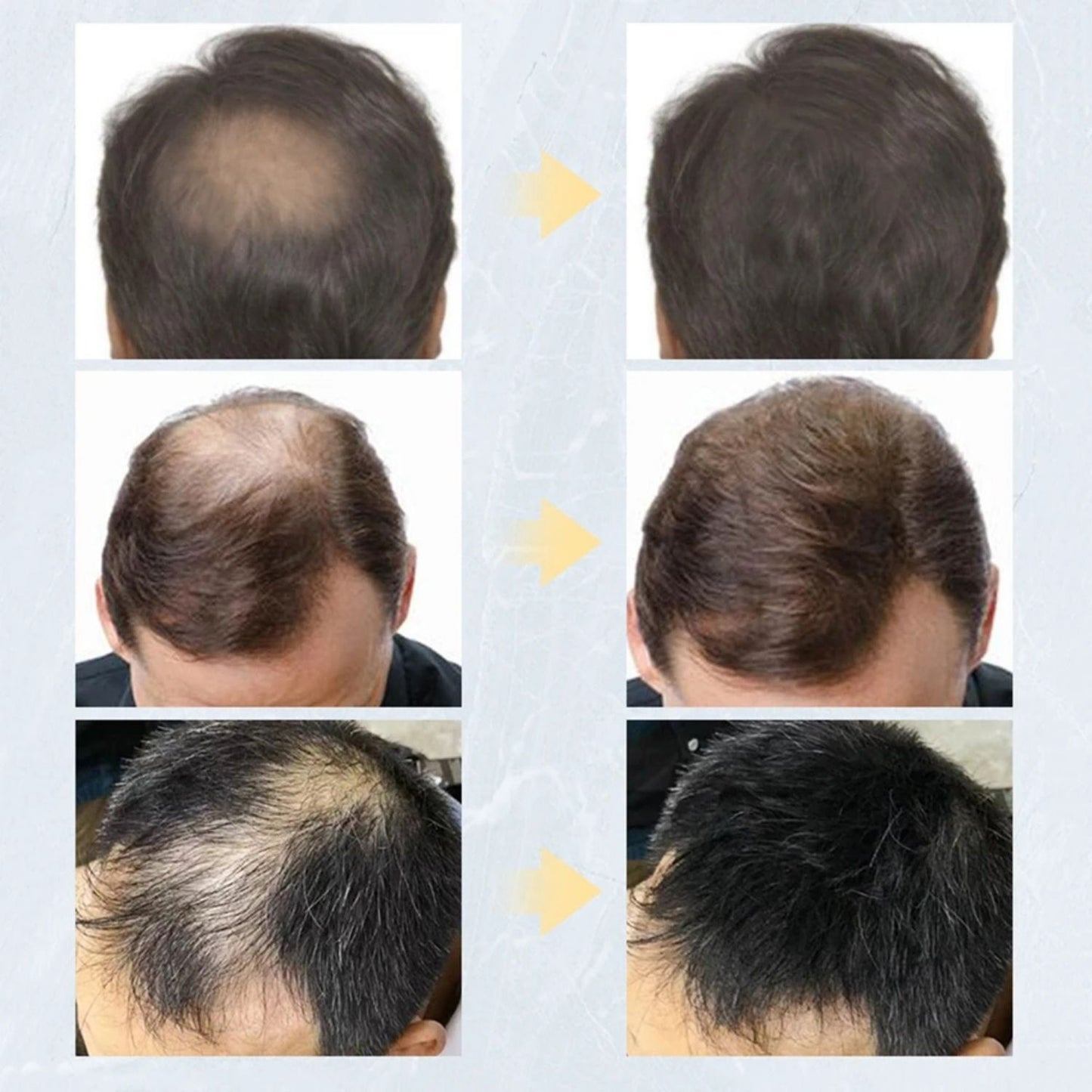 Keratin Hair Fibers Thickening Spray
