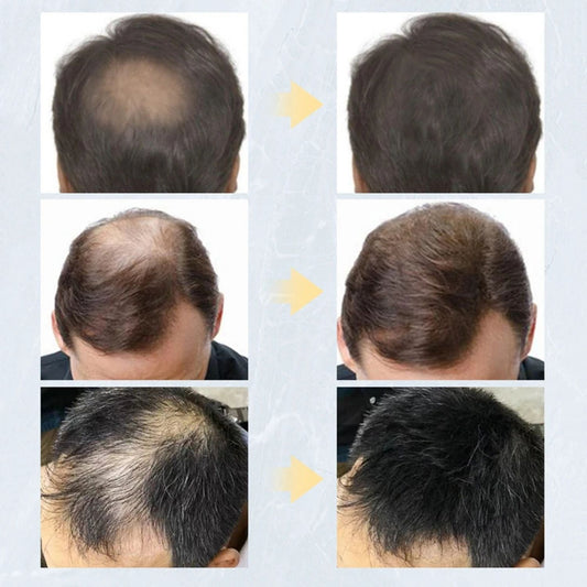 Keratin Hair Fibers Thickening Spray